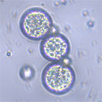 in silica microspheres seen through optical microscope